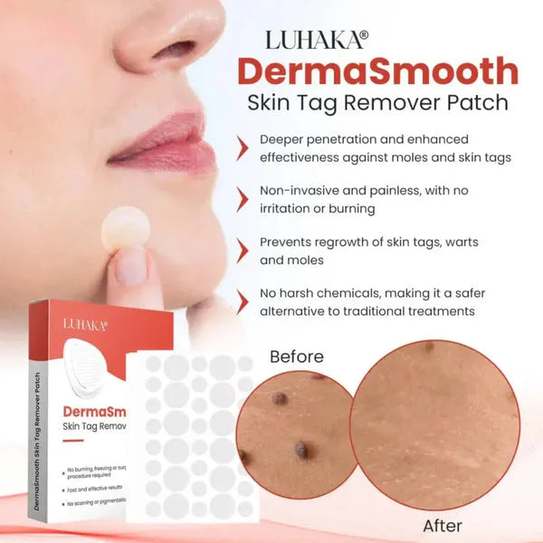 DERMA SMOOTH TAG REMOVER